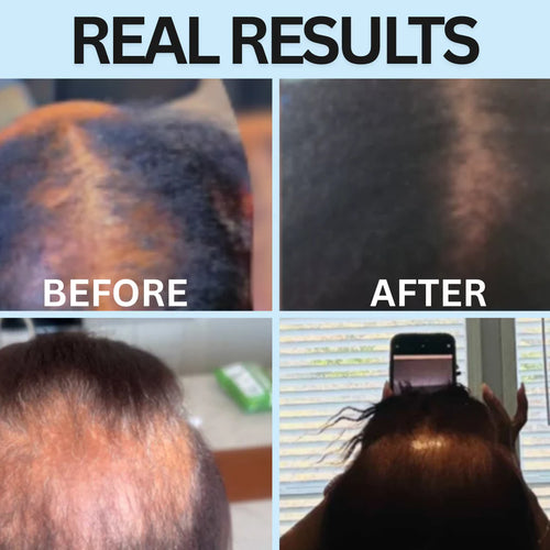 Growthly™ Hair Revival Ampoule
