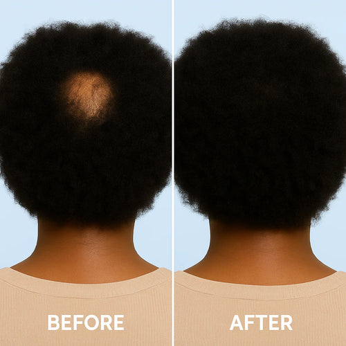 Growthly™ Hair Revival Ampoule